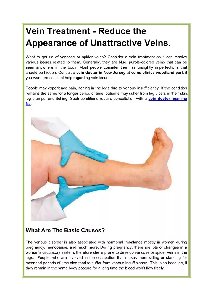 vein treatment reduce the appearance