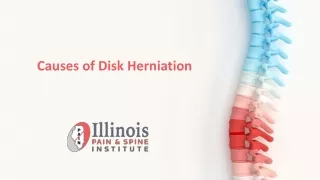 Causes of Disk Herniation