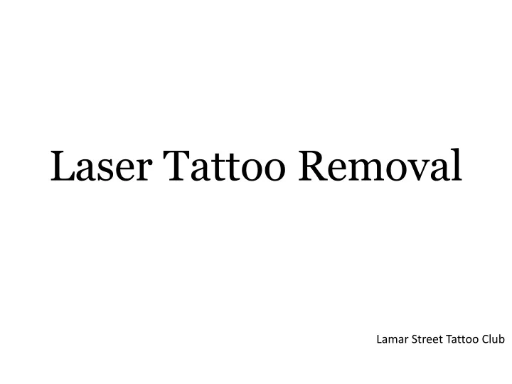 laser tattoo removal