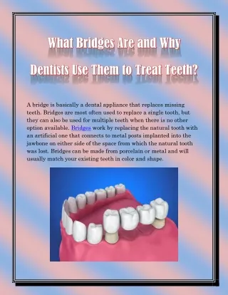 a bridge is basically a dental appliance that