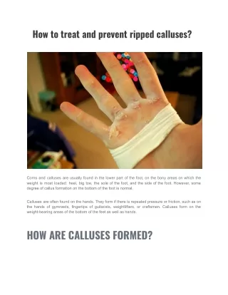 How to treat and prevent ripped calluses