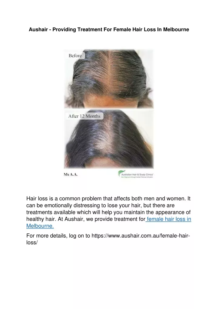 aushair providing treatment for female hair loss