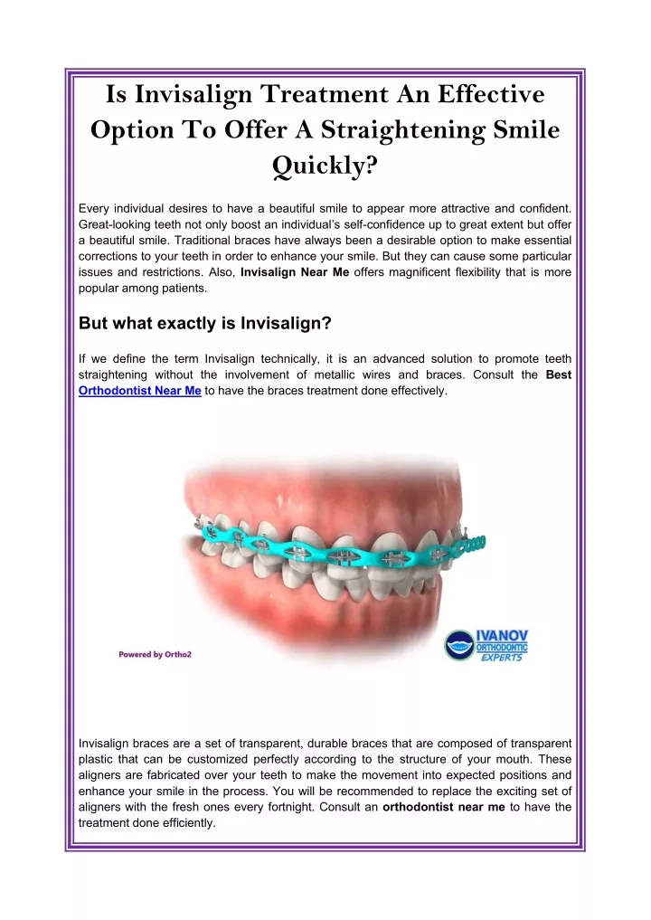 is invisalign treatment an effective option