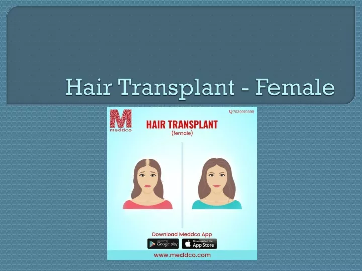 hair transplant female