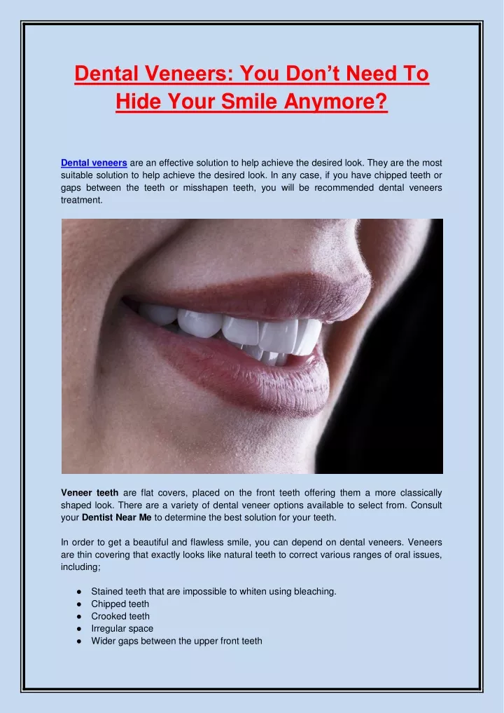 dental veneers you don t need to hide your smile