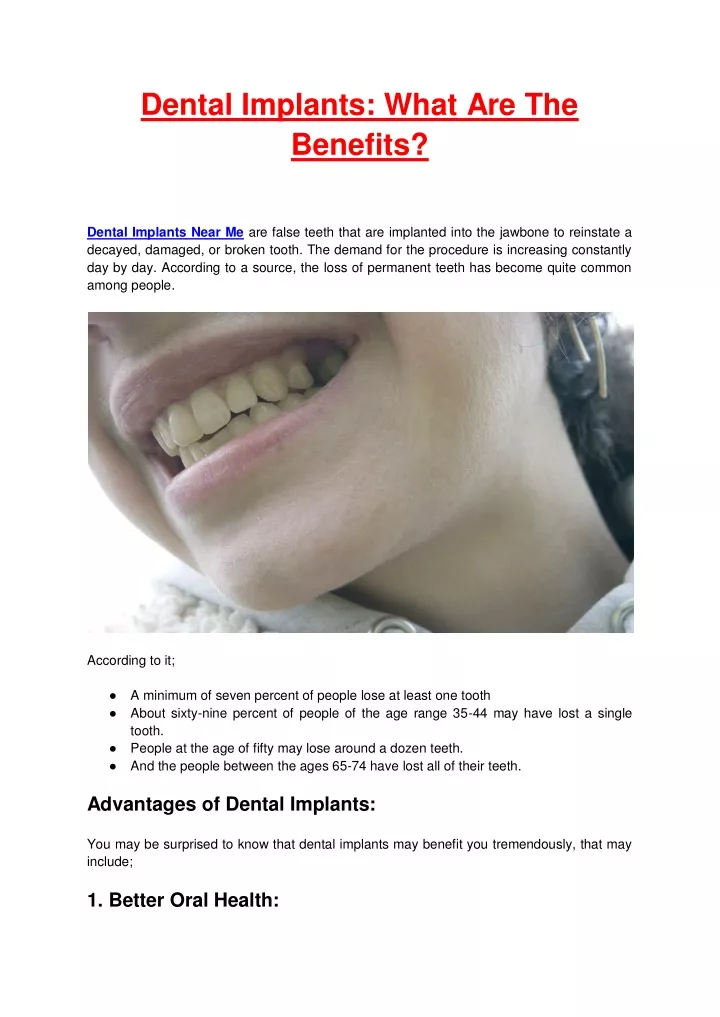 dental implants what are the benefits