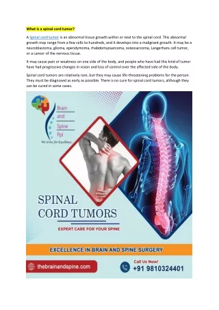 The Truth About Spinal Cord Tumors Symptoms,Treatments, Prevention of spinal cord tumor