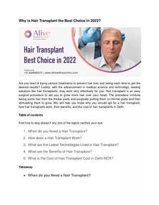 Why is Hair Transplant the Best Choice in 2022