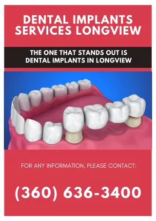 Affordable Dental Implants in Longview, Washington