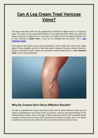 Can A Leg Cream Treat Varicose Veins