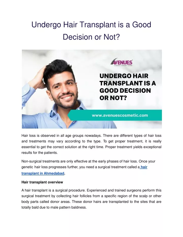 undergo hair transplant is a good decision or not