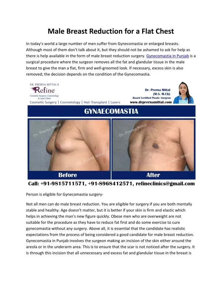 PPT - Male Breast Reduction for a Flat Chest PowerPoint