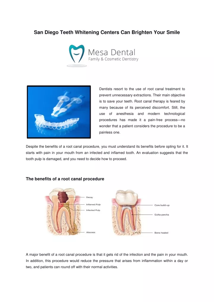 PPT - San Diego Teeth Whitening Centers Can Brighten Your Smile