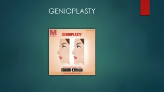 Genioplasty  - Meddco