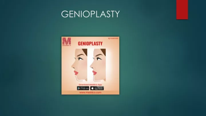 genioplasty