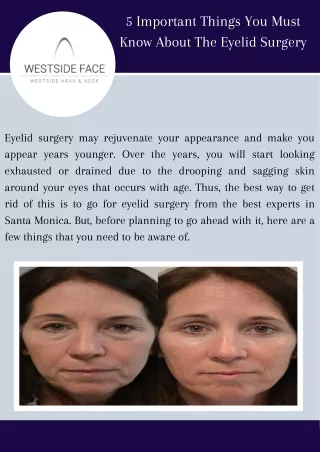 5 Important Things You Must Know About The Eyelid Surgery