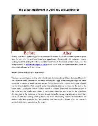 The Breast Upliftment in Delhi You are Looking For