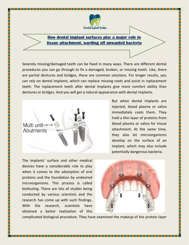 how dental implant surfaces play a major role