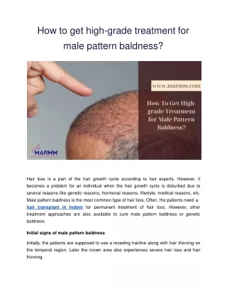How to get high-grade treatment for male pattern baldness