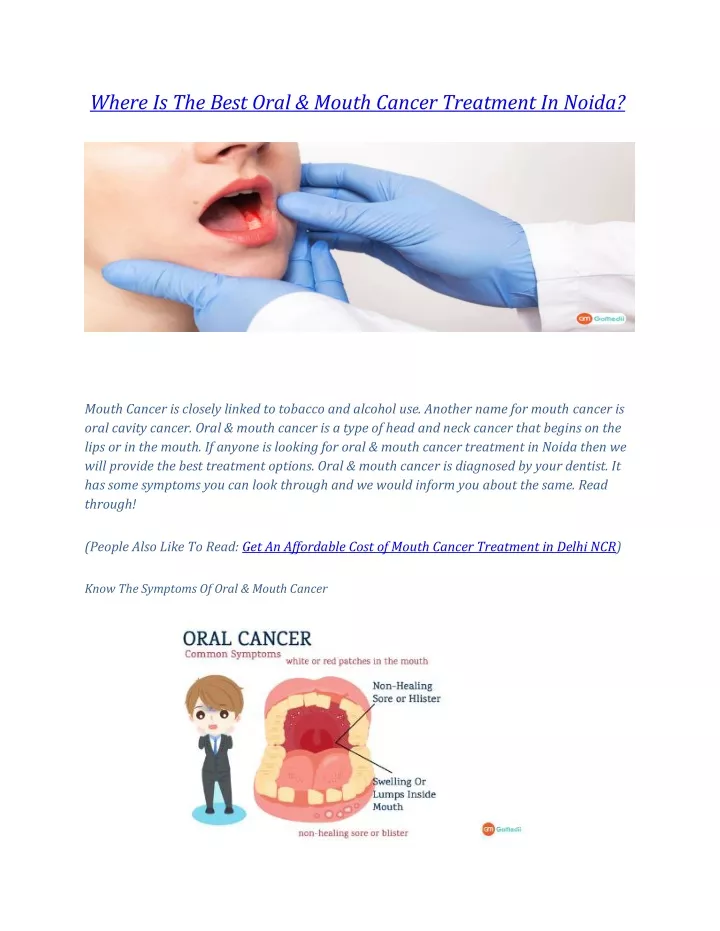 where is the best oral mouth cancer treatment