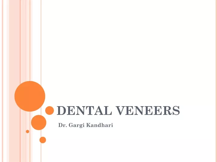 dental veneers