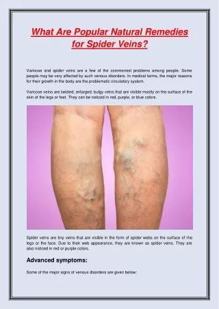What Are Popular Natural Remedies for Spider Veins