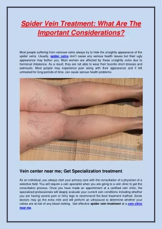 Spider Vein Treatment What Are The Important Considerations