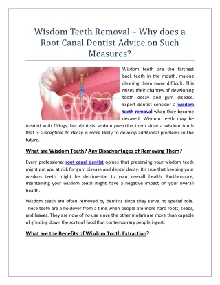 Wisdom Teeth Removal – Why does a Root Canal Dentist Advice on Such Measures