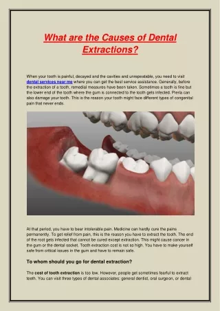 What are the Causes of Dental Extractions
