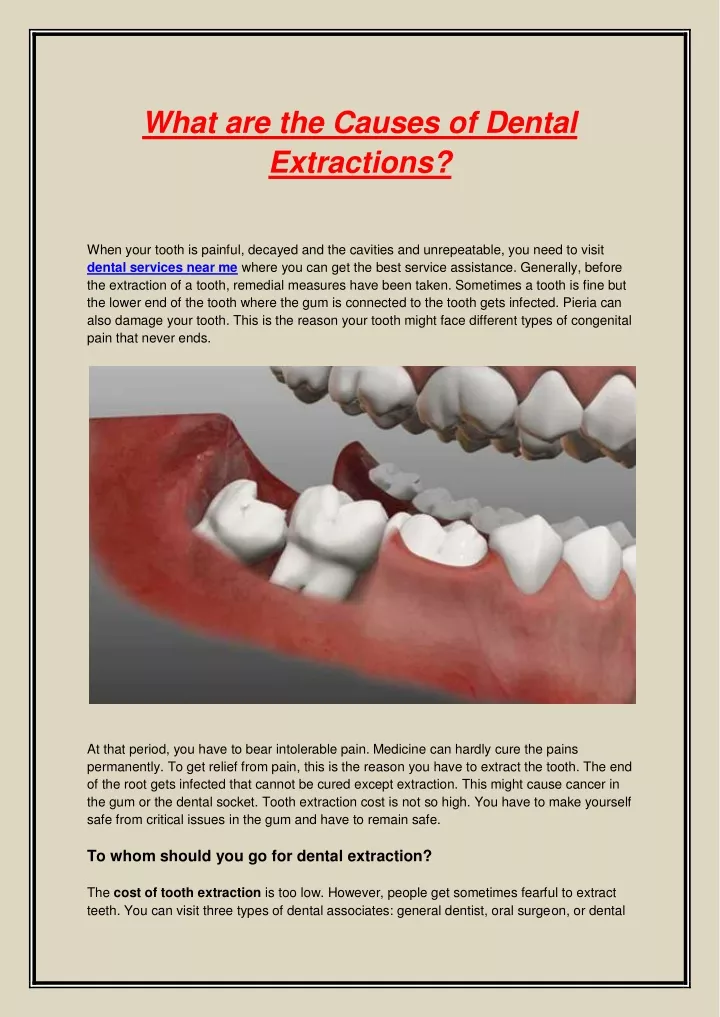 what are the causes of dental extractions