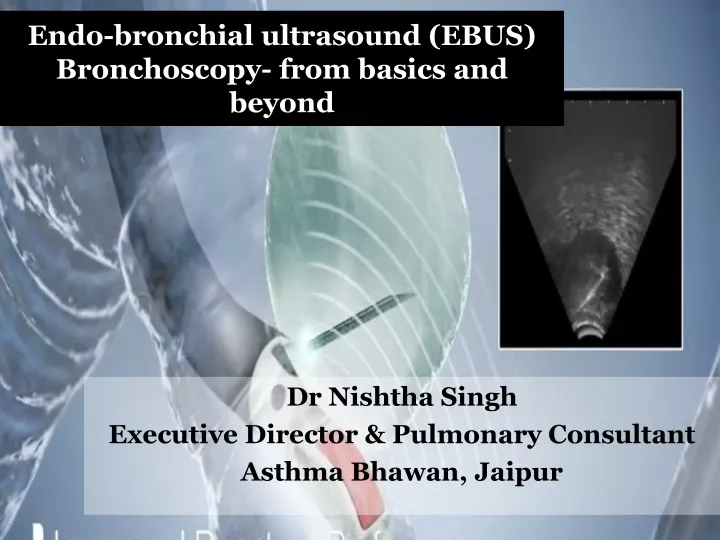 endo bronchial ultrasound ebus bronchoscopy from basics and beyond