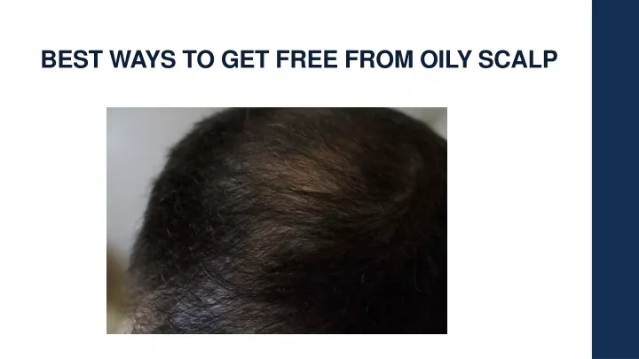 best ways to get free from oily scalp