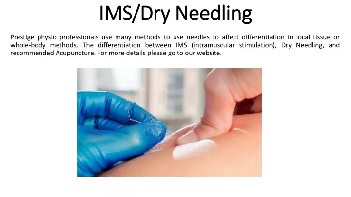 ims dry needling