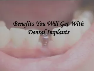Benefits You Will Get With Dental Implants