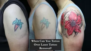 When Can You Tattoo Over Laser Tattoo Removal