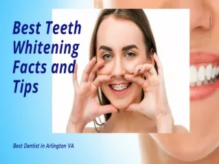 Best Teeth Whitening Facts and Tips