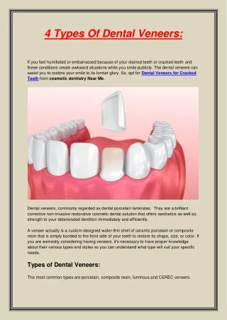 4 types of dental veneers