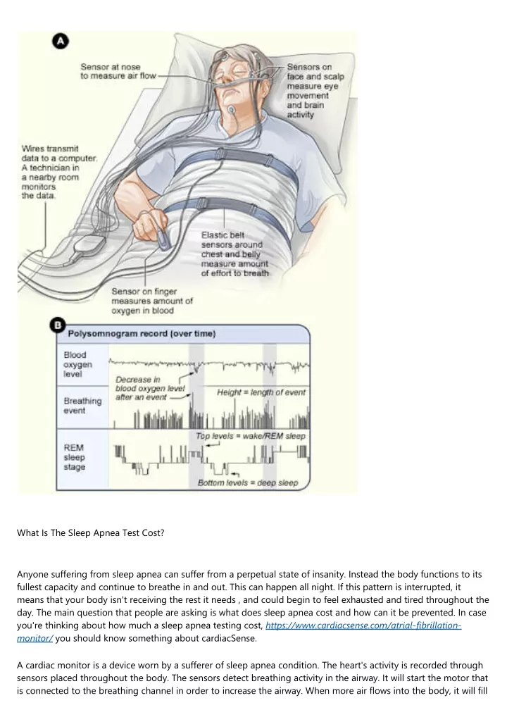 what is the sleep apnea test cost