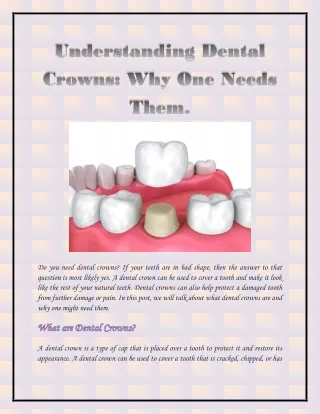 Understanding Dental Crowns: Why One Needs Them.