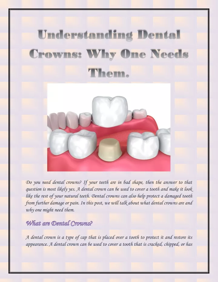 do you need dental crowns if your teeth