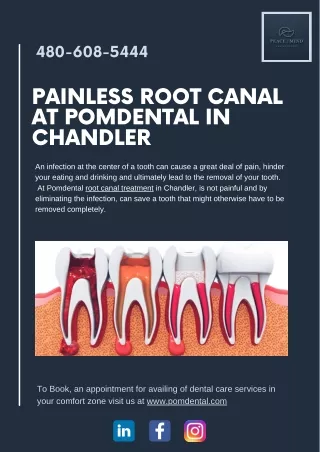 Painless Root Canal at Pomdental in Chandler