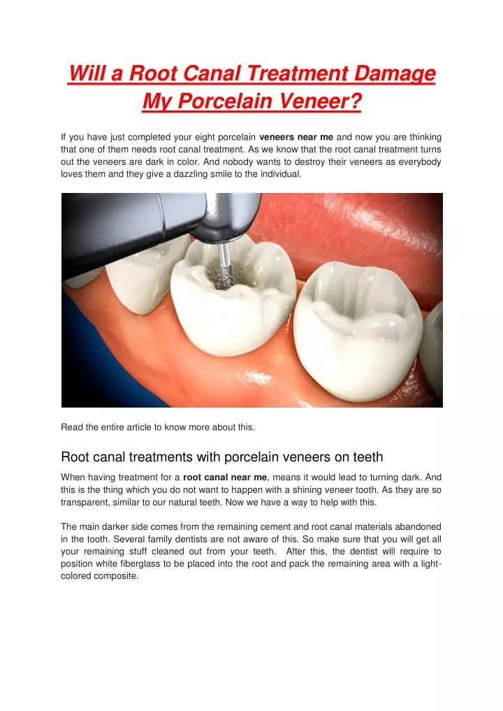 will a root canal treatment damage my porcelain