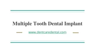 PPT 2-Multiple Tooth Dental Implant