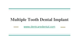 multiple tooth dental implant