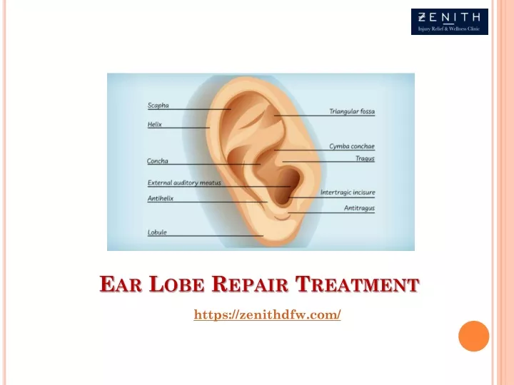 ear lobe repair treatment