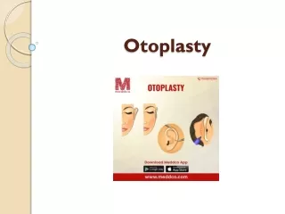 Otoplasty