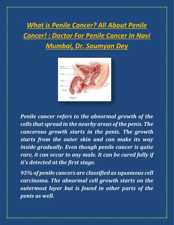 what is penile cancer all about penile cancer