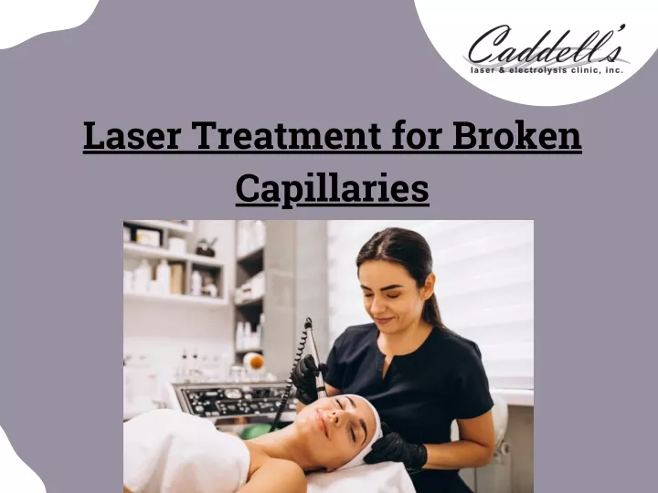 laser treatment for broken capillaries