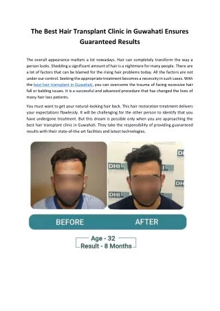 The Best Hair Transplant Clinic in Guwahati Ensures Guaranteed Results