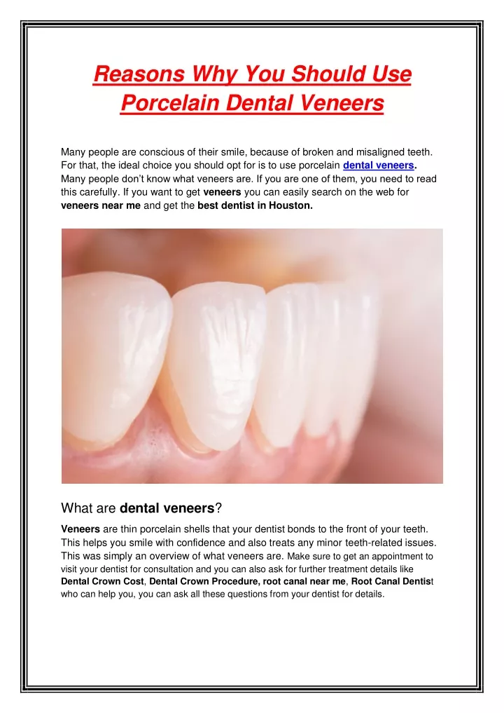 reasons why you should use porcelain dental